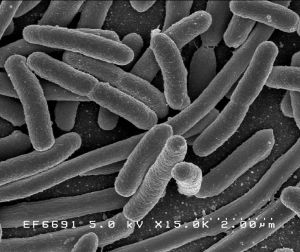 Scanning electron micrograph of Escherichia coli, grown in culture and adhered to a cover slip (Rocky Mountain Laboratories)